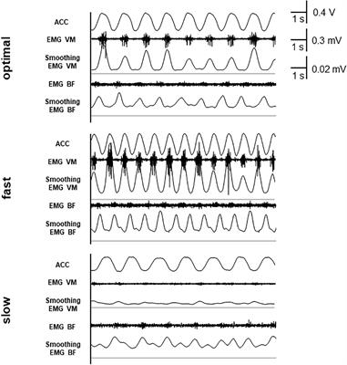 The Effect of Pedaling at Different Cadence on Attentional Resources